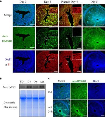 The regulation and function of acetylated high-mobility group box 1 during implantation and decidualization